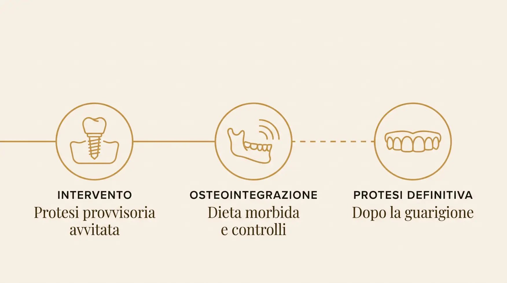 Le tre fasi del carico immediato, dalla protesi provvisoria alla protesi definitiva