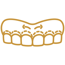 Gummy Smile Correction Albania - Aesthetic Dentistry